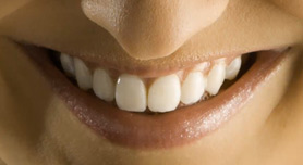 Tanden witter maken